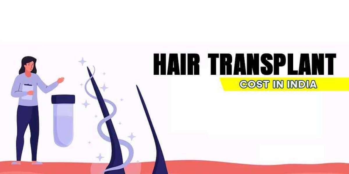 Hair Transplant Cost in India: How Much Should You Expect to Pay?