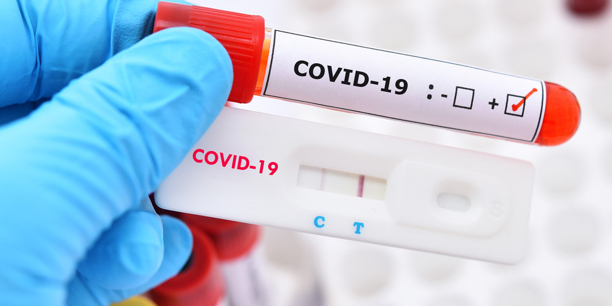 Everything You Need Know About Covid Testing in Wilmington, CA
