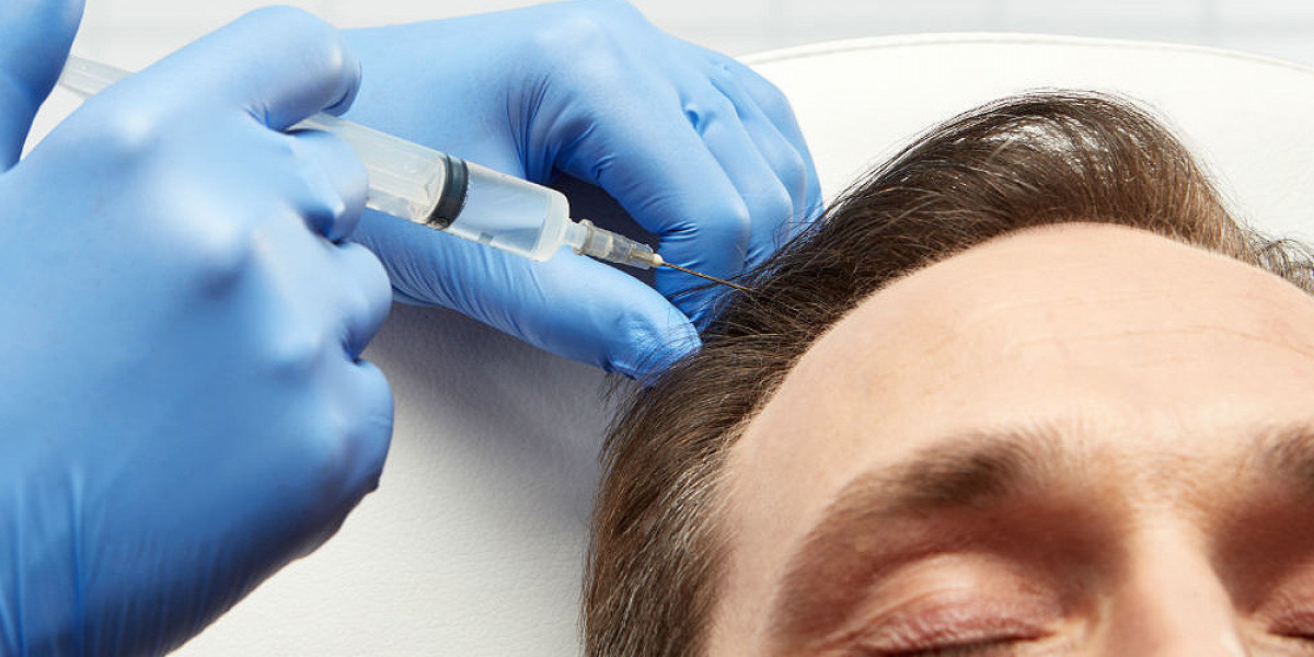 Considering A PRP Hair Treatment: Everything You Need To Know